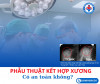 PHẪU THUẬT KẾT HỢP XƯƠNG LÀ GÌ? ĐẶT ĐINH – NẸP – VÍT CÓ NGUY HIỂM KHÔNG?