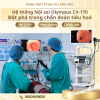 Hệ thống nội soi Olympus CV-170 - Đột phá mới trong chẩn đoán tiêu hóa tại Trung tâm Y tế khu vực Lâm Thao